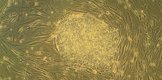 colony of embryonic stem cells, from the H9 cell line (NIH code: WA09). Viewed at 10X